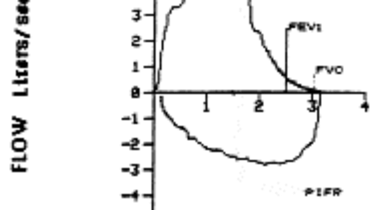 Tracheomalacia Flow Volume Loop