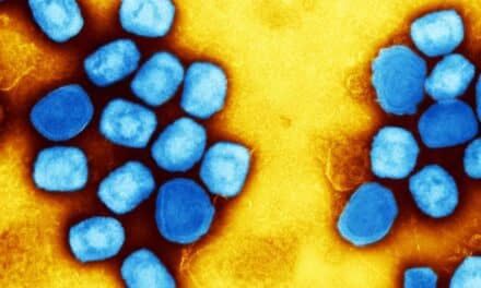Tecovirimat Safe But Ineffective Against clade II mpox