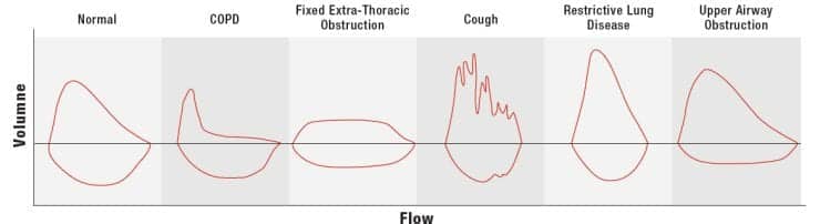 MedGraphics® CPFS/D™ USB spirometer