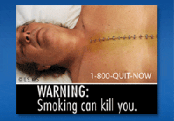 Graphic Pictures Deter More Smokers than Text-Only Warning Labels