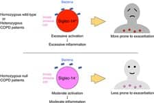 Researchers ID Protein Linked to COPD Exacerbation