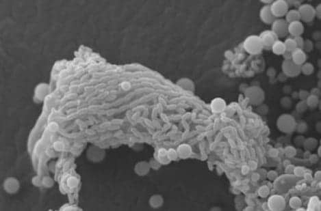 Deadly Human Pathogen Cryptococcus Fully Sequenced