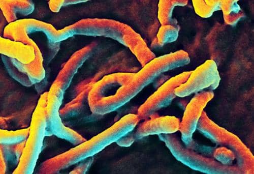 Ebola Virus Found to Linger in Lungs