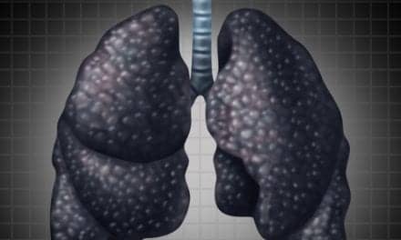 New 3D-Imaging Technique Reveals How Pulmonary Fibrosis Develops