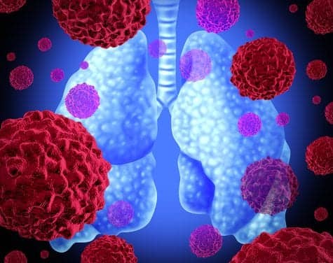 CF Foundation Grant to Fund Treatment for Bacterial Lung Infections