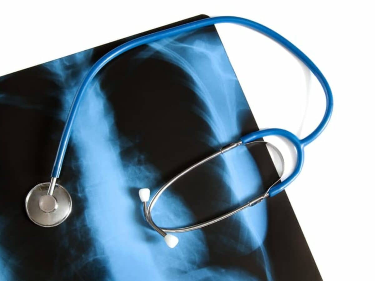 bpc 157 dosing protocol subcutaneous BPC 157 Dosage: A Doctor's Evidence-Based Guide