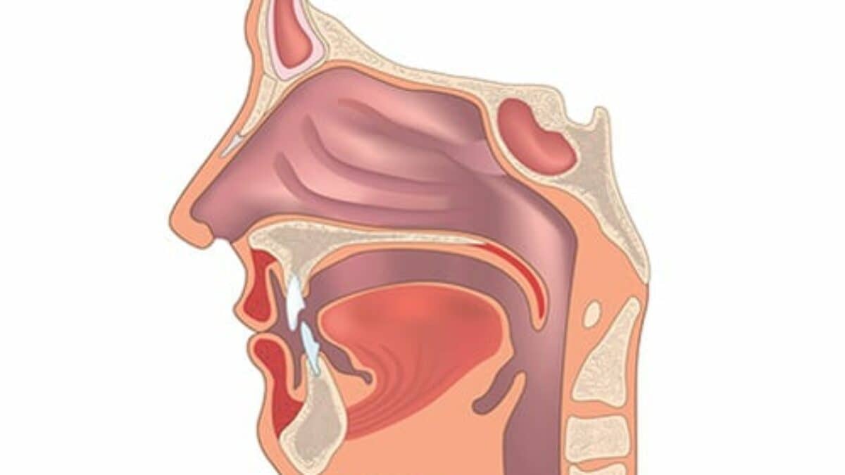 sinus-nasal-500-1200x675.jpg