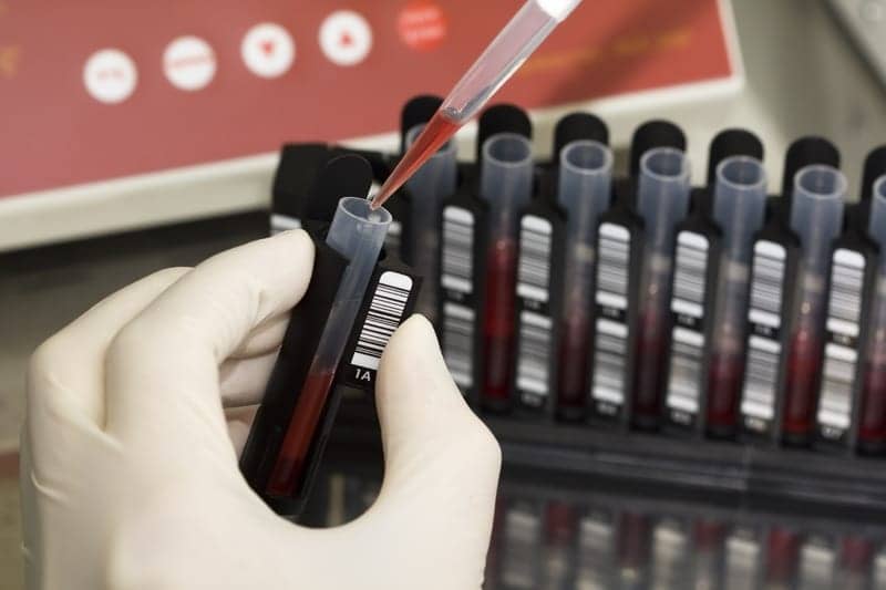 NuQ Blood Tests Accurately Detect Over 90% of Lung Cancer Cases