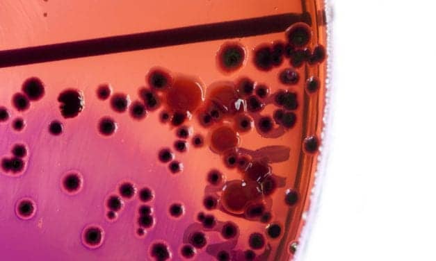 Cluster of Legionnaires’ Hits New Hampshire