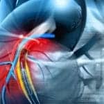 FDA Approves Stent for Pediatric Pulmonary Artery Stenosis Patients