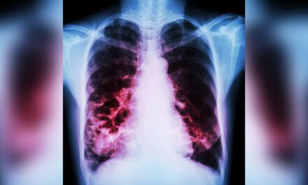 COPD Patients with Bronchiectasis Face Greater Mortality Risk