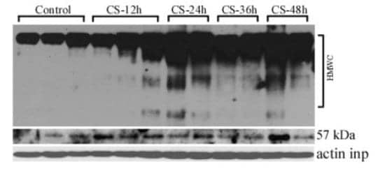 Research Reveals Collapse of Protein Homeostasis in COPD