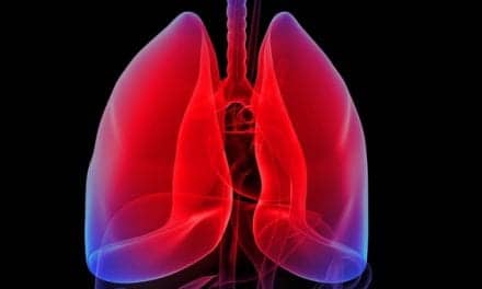 An Opportunity for New Lung Cancer Therapeutic Strategies