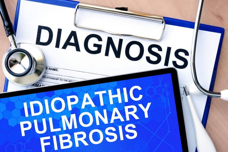 Health and Economic Burden Rises Before an IPF Diagnosis