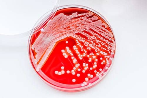 FDA Approves Zerbaxa for HAP, VAP