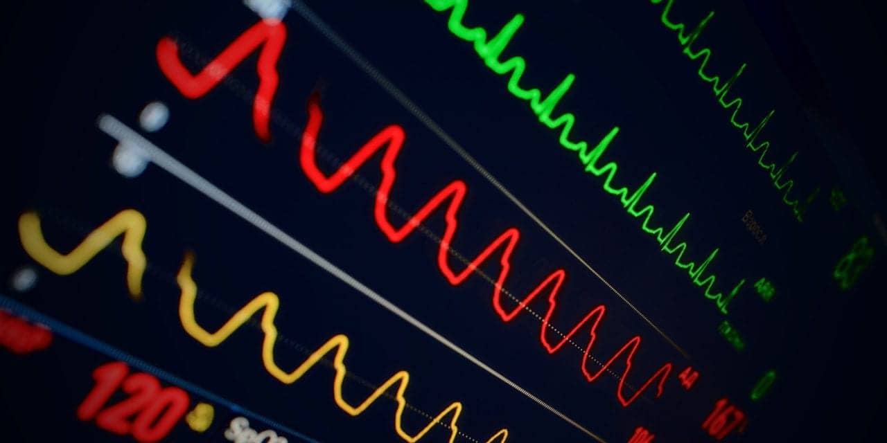 Patient Monitoring in the ICU and Trauma Center