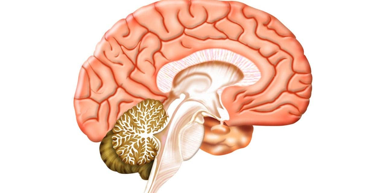 NSAID Therapy May Benefit COVID-19 Patients by Treating Inflammation in Brain