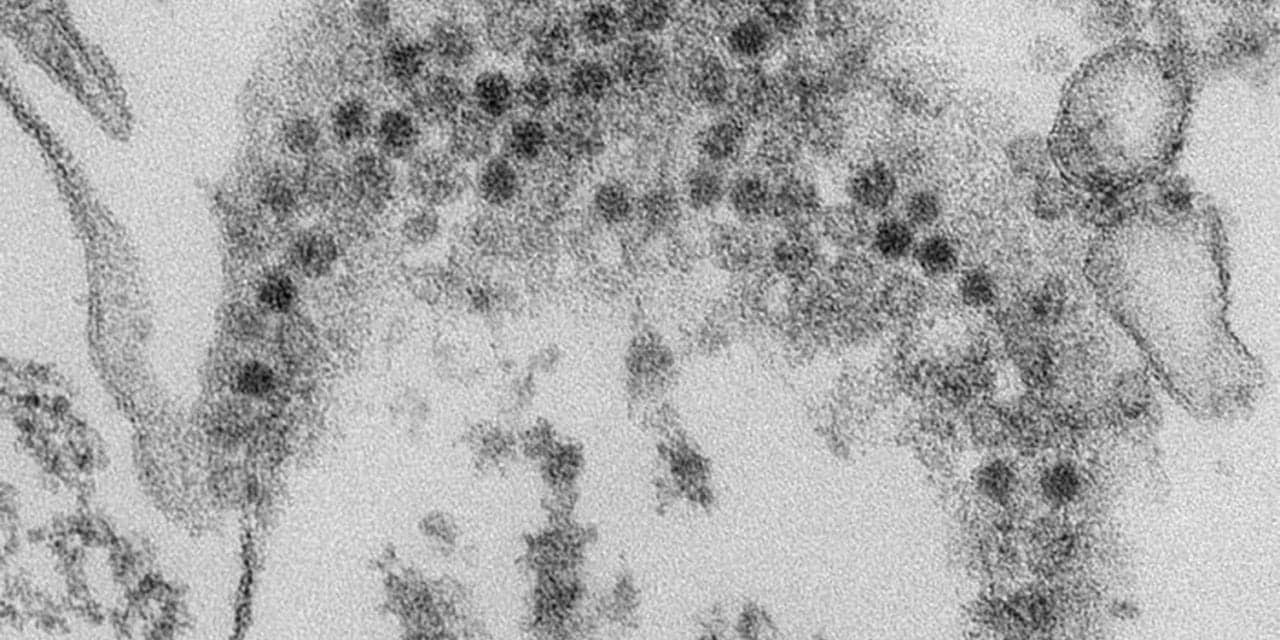 CDC: Enterovirus D68 Possibly Linked to Acute Flaccid Myelitis