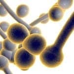 Antifungal Shows Potential Treating Severe Valley Fever