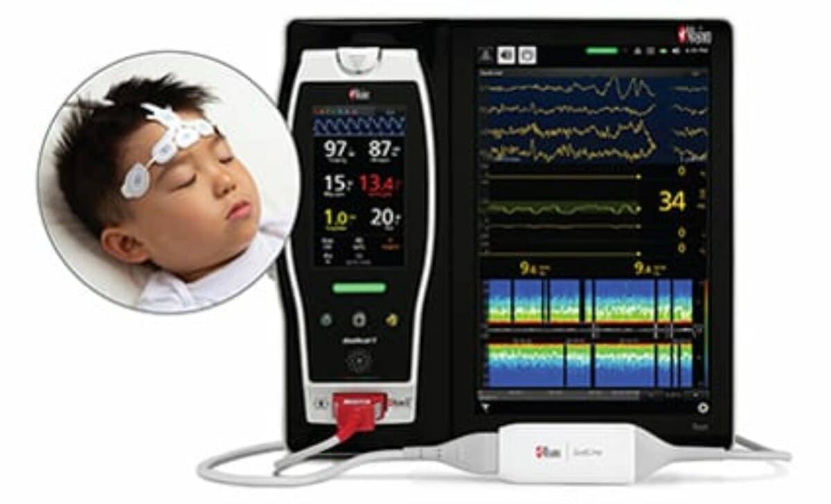 Masimo's Pediatric Brain Function Monitor Gets CE Approval | RT