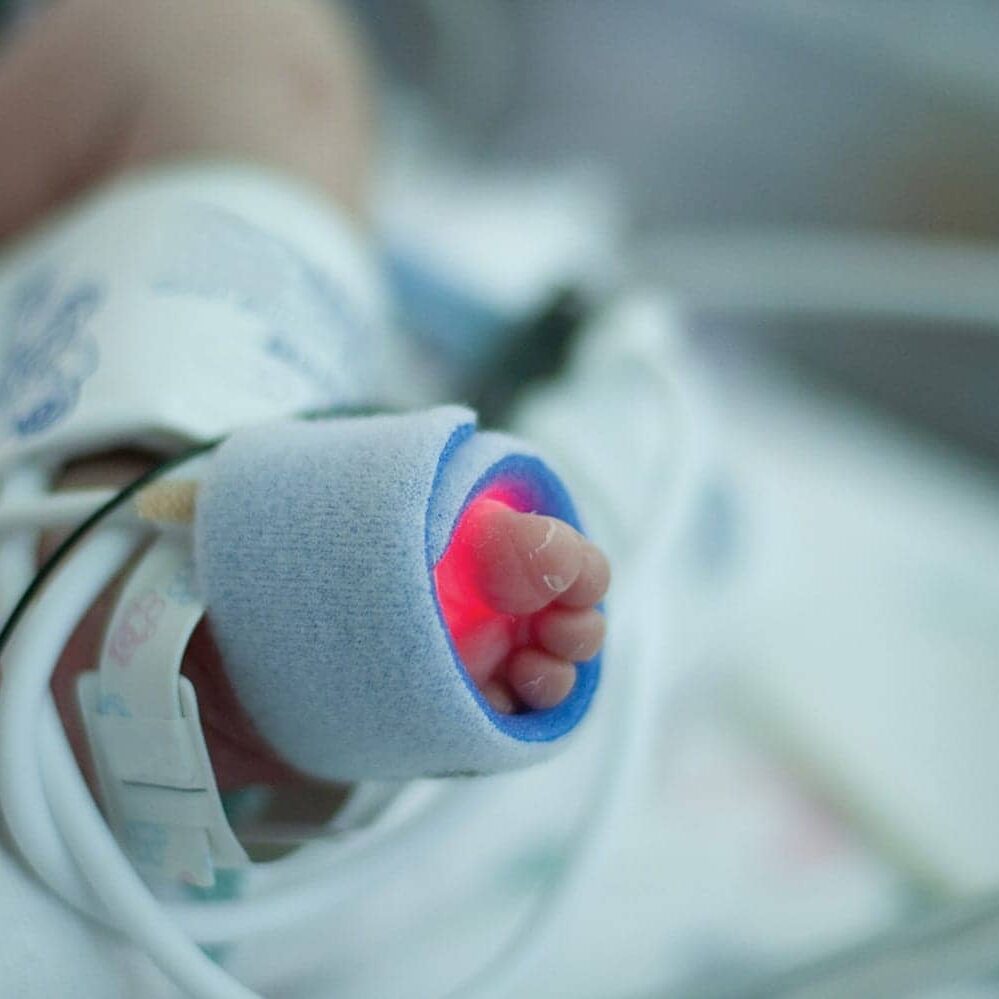 Pulse Oximetry for Screening Critical Congenital Heart Defects | RT
