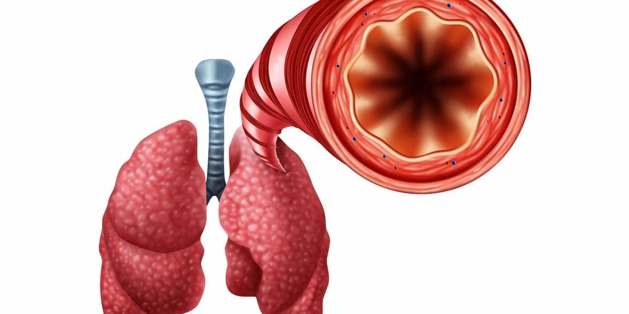 COPD: Positive Data for RheOx Bronchial Rheoplasty System