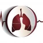 Smoking Cessation Adds Five Healthy Years to Heart Disease Patients