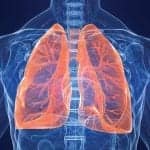 Airway Clearance Options for Patients with Bronchiectasis