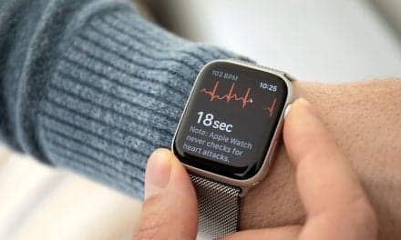 Apple Watch ECG Versus Standard ECG