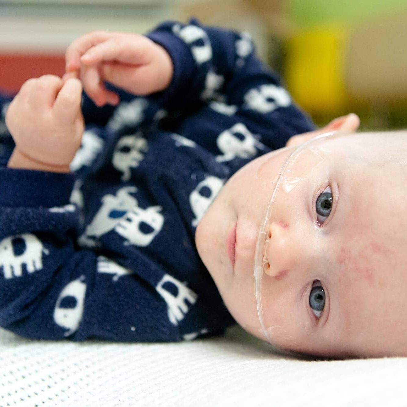 O2 Pediatric Nasal Prongs: Ensuring Optimal Oxygen Delivery for Kids
