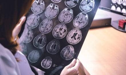 Daytime Sleepiness Tied to Greater Dementia Risk for Female Seniors
