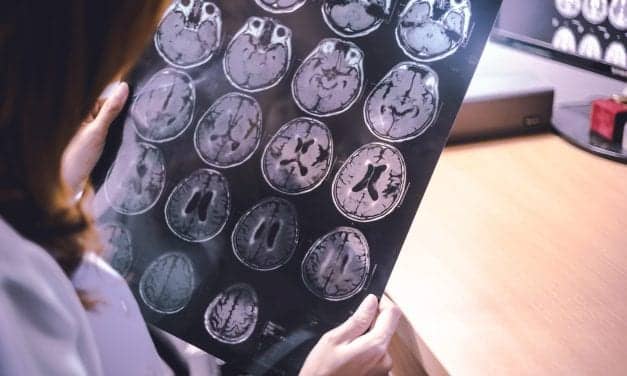 Daytime Sleepiness Tied to Greater Dementia Risk for Female Seniors