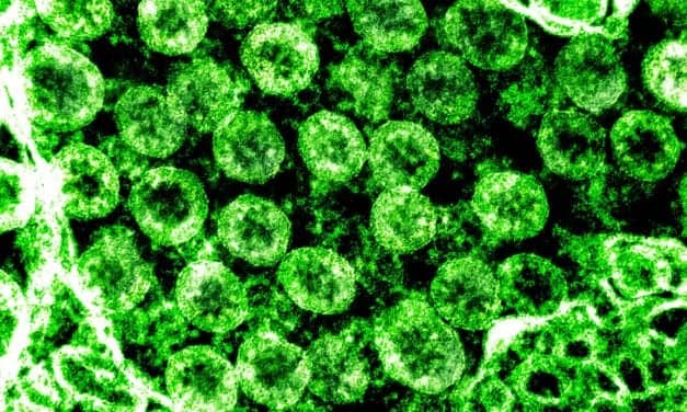 bioMérieux Launches WatchFire PCR Test to Detect Respiratory Pathogens in Wastewater
