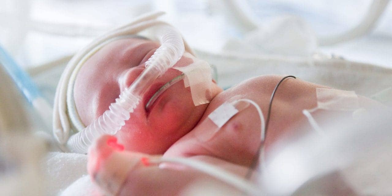 One-time Preemie Now a Neonatal Physician Treating Infants with ...