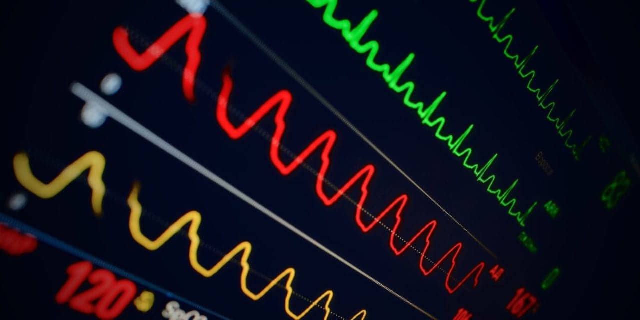 EKGs May Indicate Worsening COVID-19 or Influenza