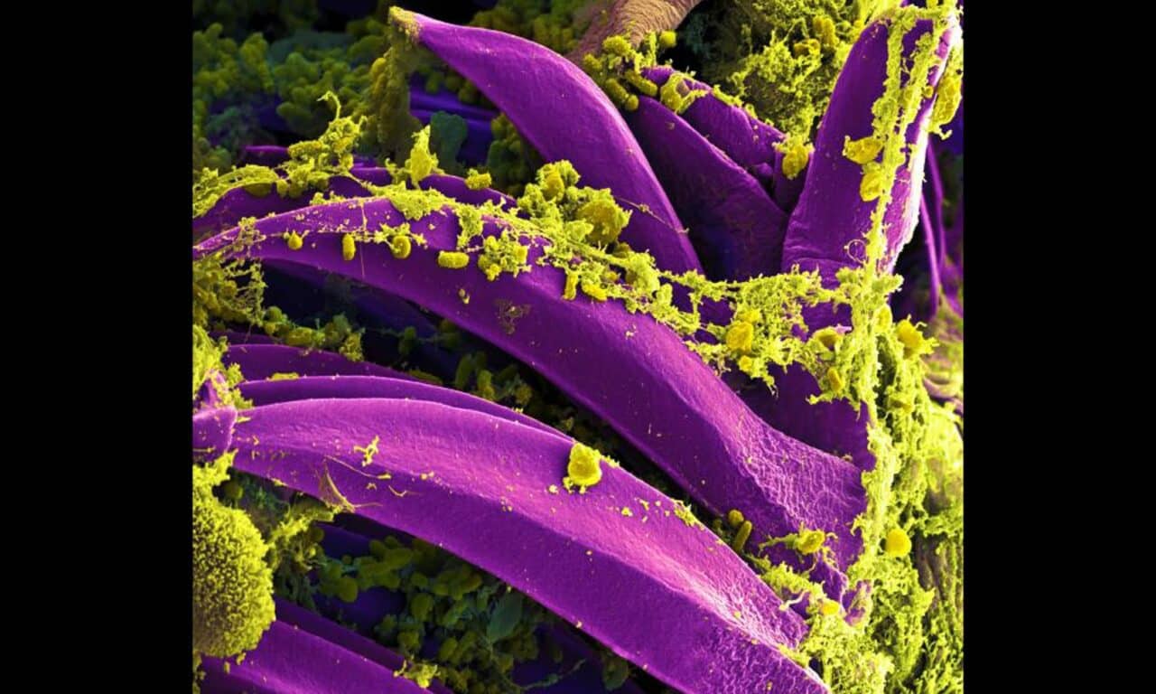 US Monitoring Possible Pneumonic Plague-related Death in Russia