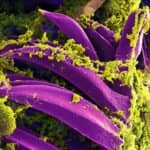 US Monitoring Possible Pneumonic Plague-related Death in Russia