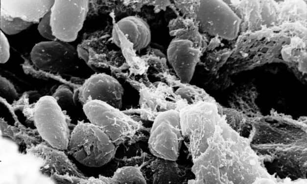 Pneumonic Plague Discovered in Wyoming