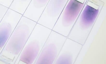 Ai Could Improve Allergy Skin Test Accuracy