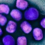 Agencies Establish Global Mpox Vaccine Stockpile