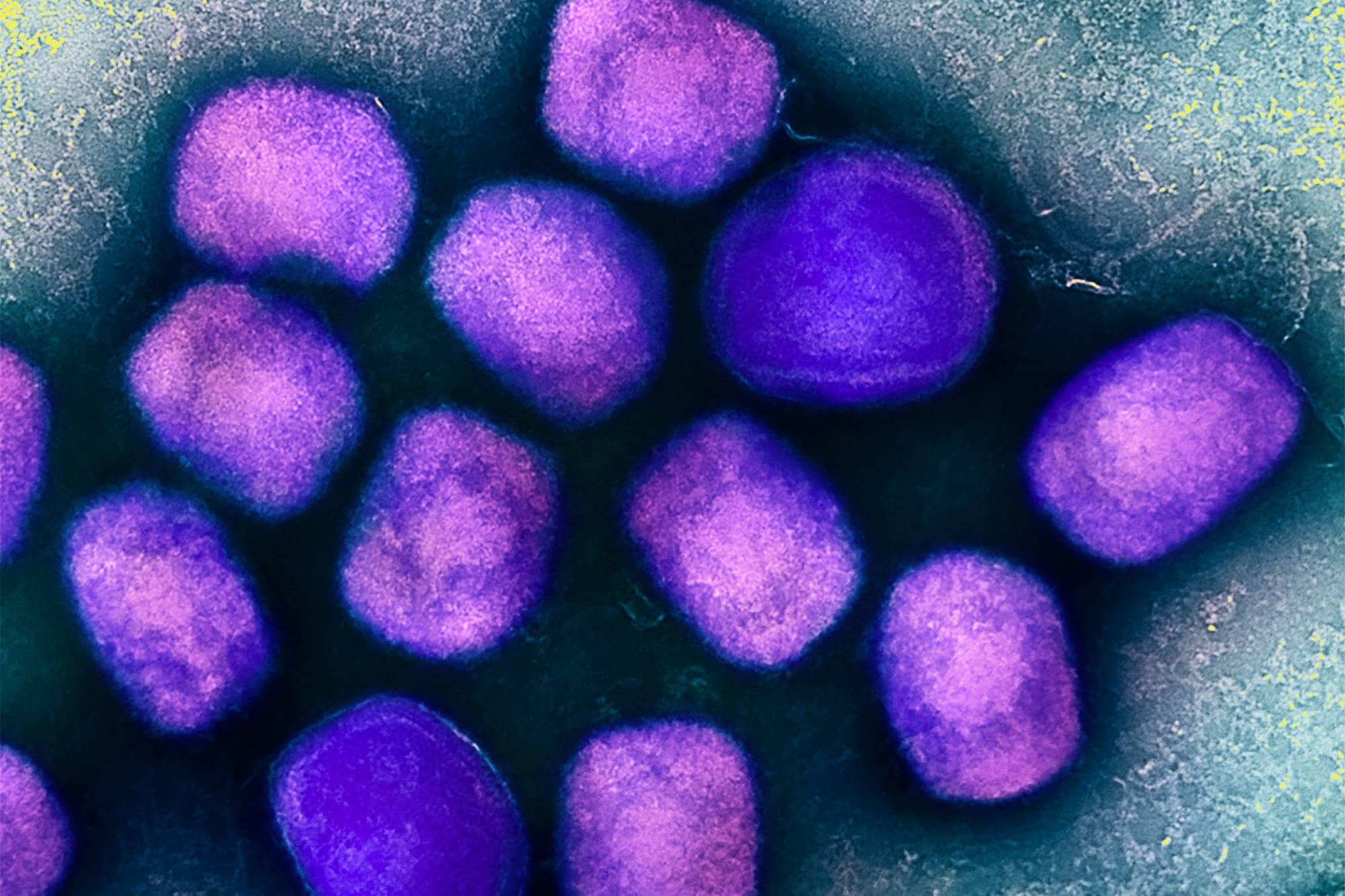 Agencies Establish Global Mpox Vaccine Stockpile