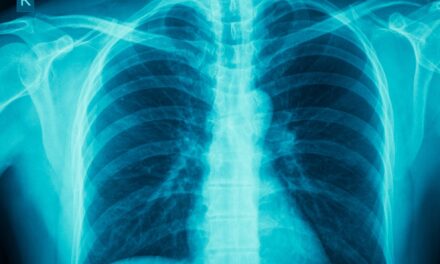 Dupilumab Lessens Disease in COPD Patients