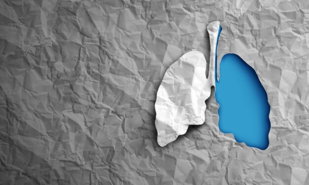 Race-neutral Testing Key to Equal Lung Transplant Access