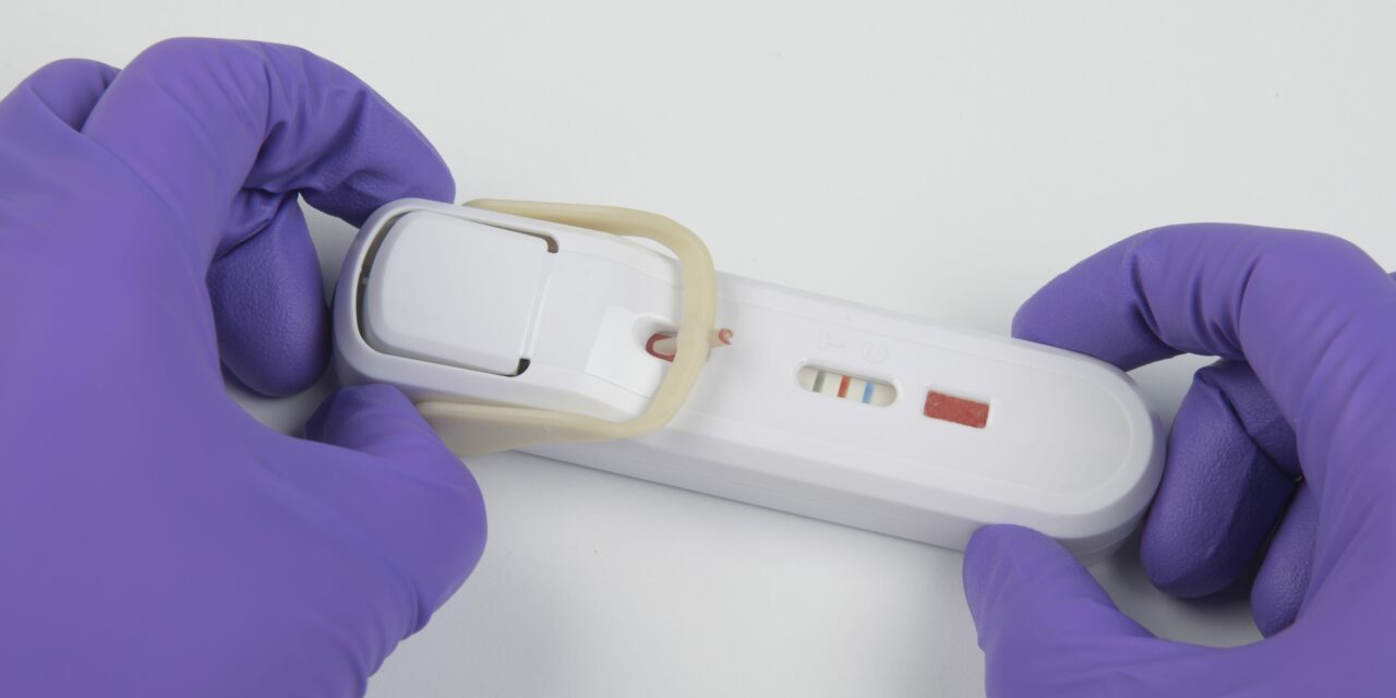 FDA Clears FebriDx Test to Differentiate Viral and Bacterial Respiratory Infections