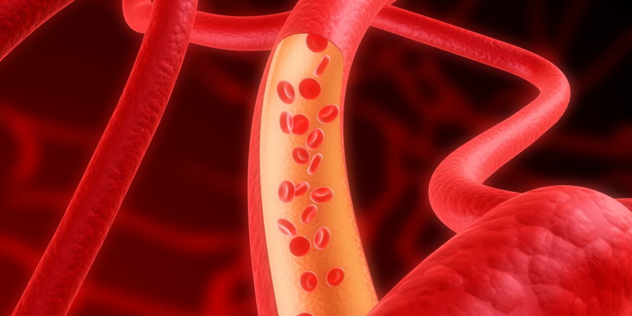 Pulmonary Artery Denervation Had Clinical Benefits in Pulmonary Hypertension