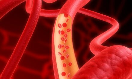 Pulmonary Artery Denervation Had Clinical Benefits in Pulmonary Hypertension