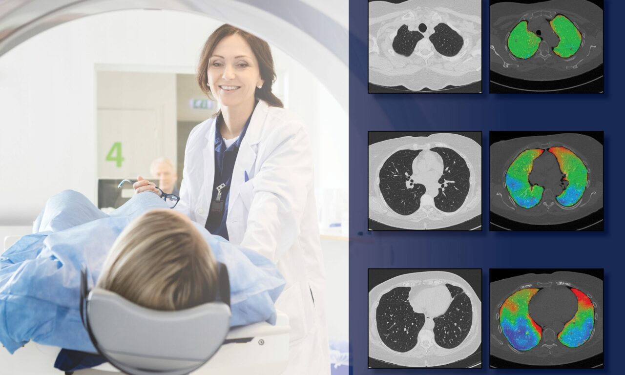 FDA Clears CT-based Lung Function Scanning Software