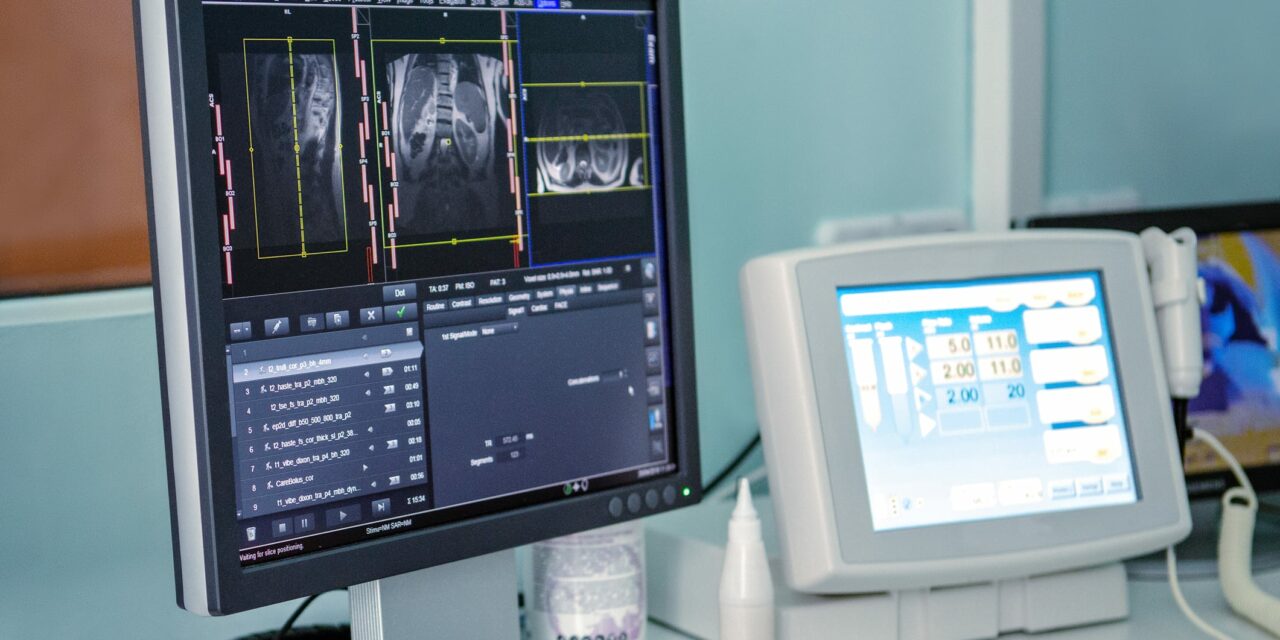 Equitable Lung Cancer Screening Access