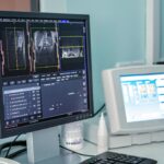 FDA Clears CT-based Lung Function Scanning Software