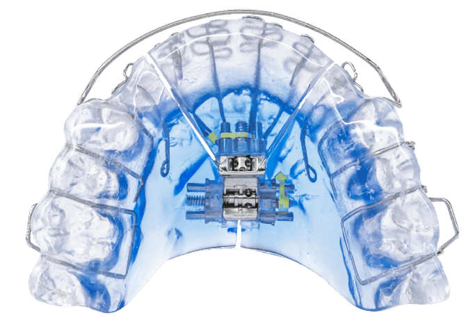 FDA Clears Vivos’ Oral Appliances for Severe Sleep Apnea